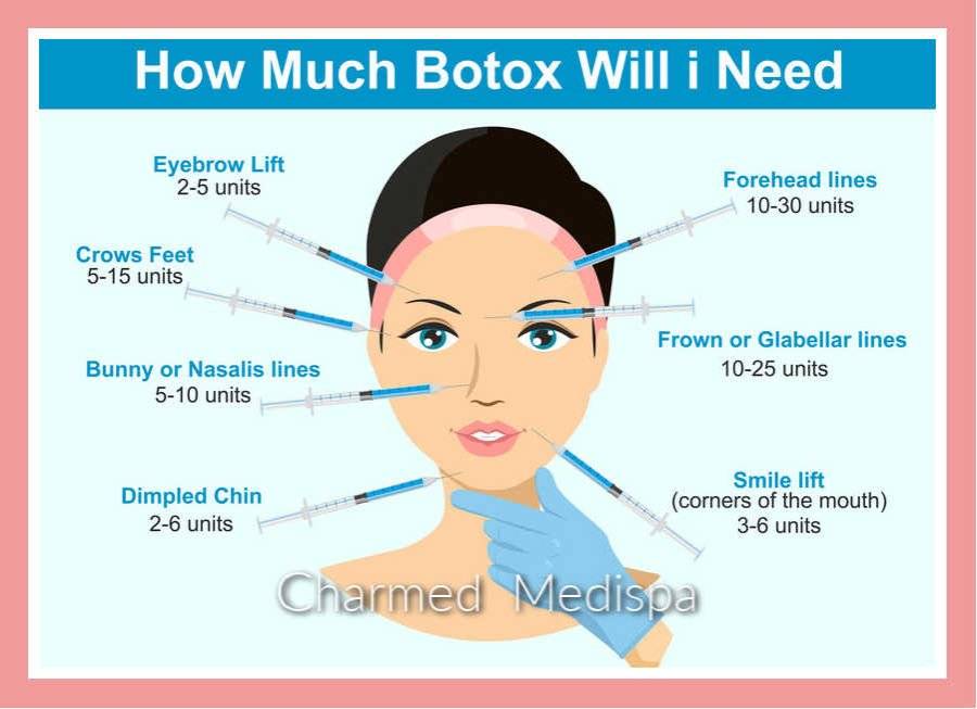 Charmed-Medispa-Botox-Unit-Cost-1.jpg