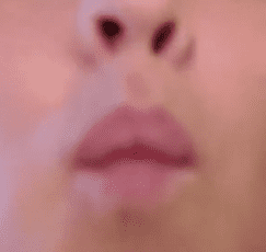 herpes lips.PNG