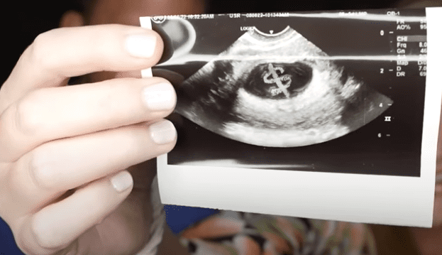 sonogram.png
